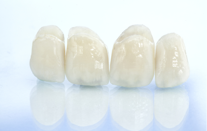 4 ceramic crowns set on a table. 