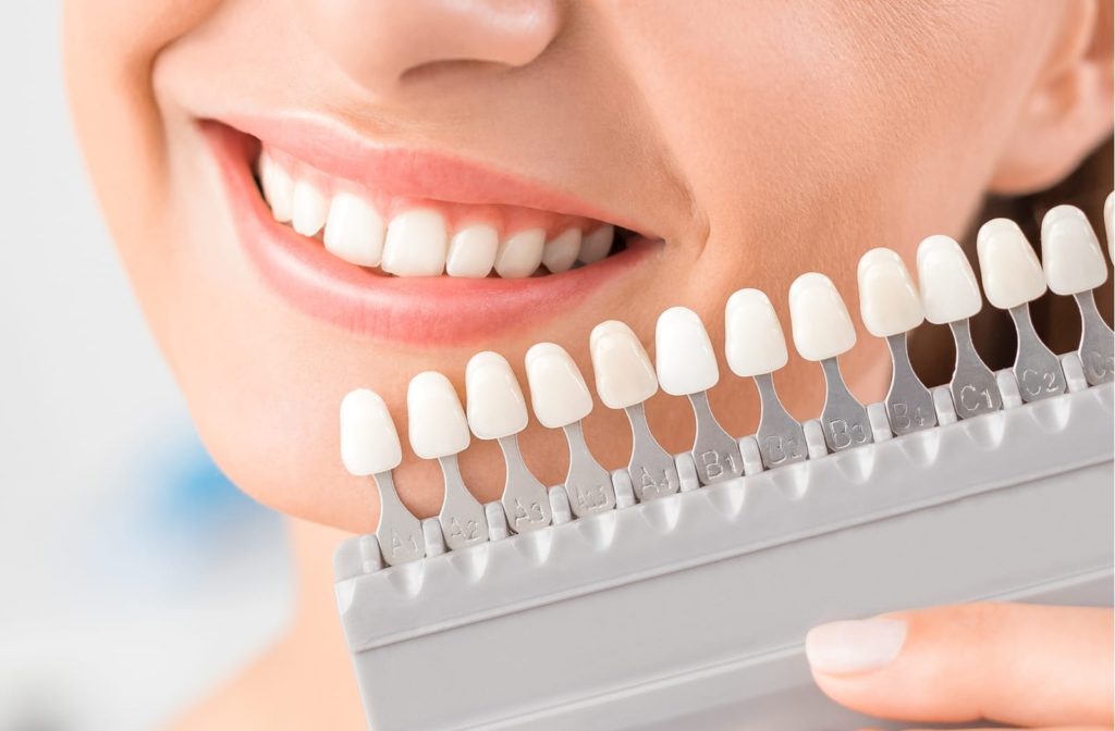Matching the shades of a dental crown to a white smile