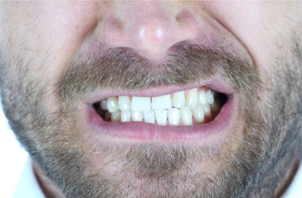 A close up of a man clenching and grinding his teeth
