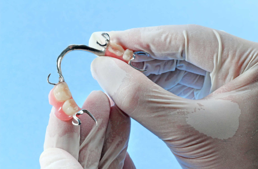 A dentist wearing white medical gloves holding a partial denture to show an alternative to a dental bridge.