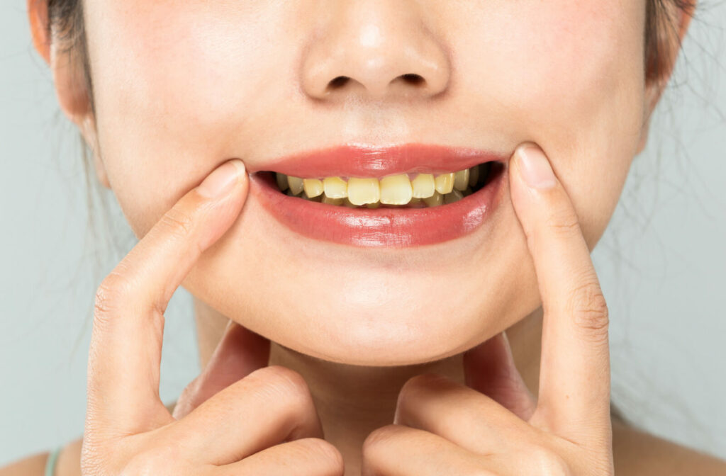 a young woman is seen opening her mouth wide with her fingers while showing her teeth.
