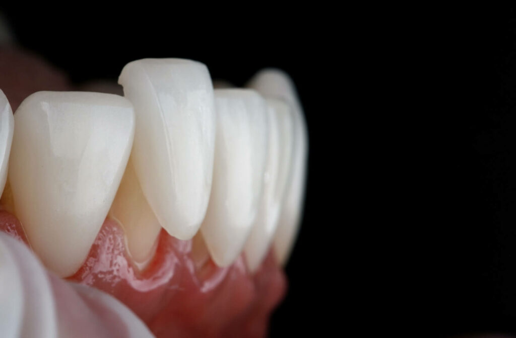 a macro dental photo of a veneer on top of a person's natural tooth.