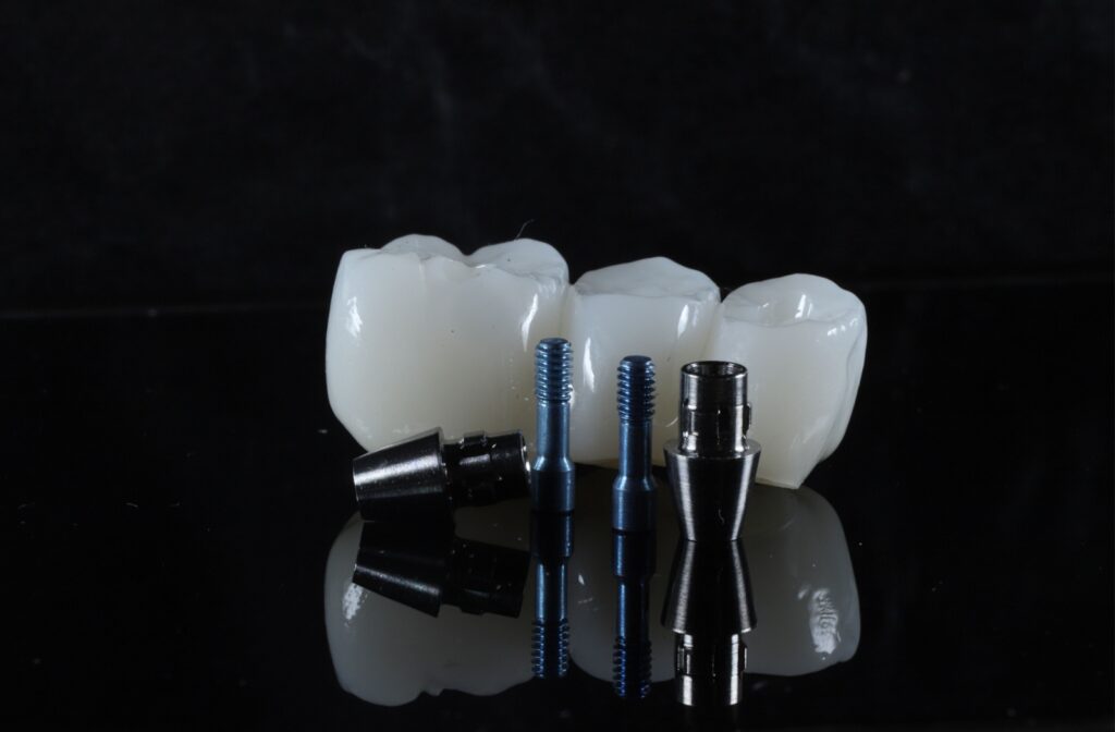 A portrait image of shiny dental implant hardware and a custom white crown.