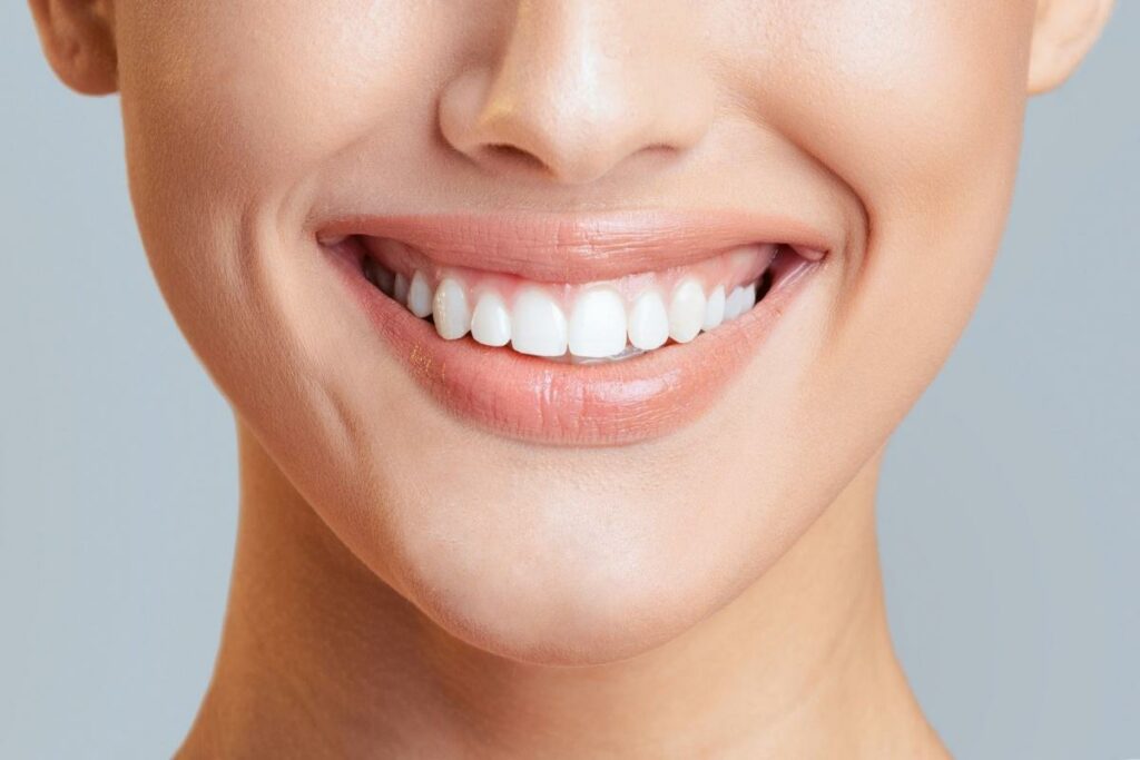 A close up of a smile with perfect teeth